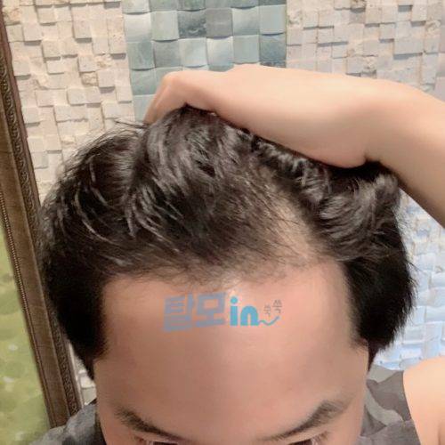 핀주브 800정 photo review