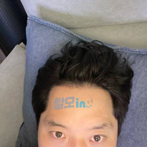 핀주브 800정 photo review