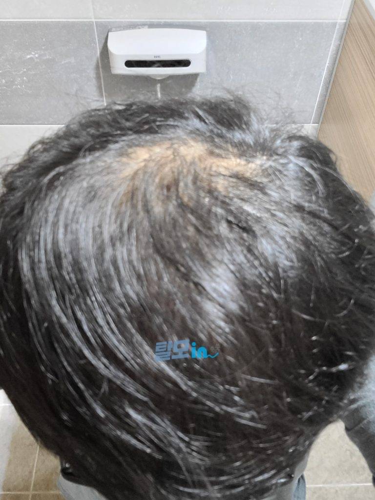 핀페시아 900정 photo review