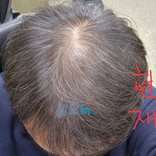 핀페시아 900정 photo review