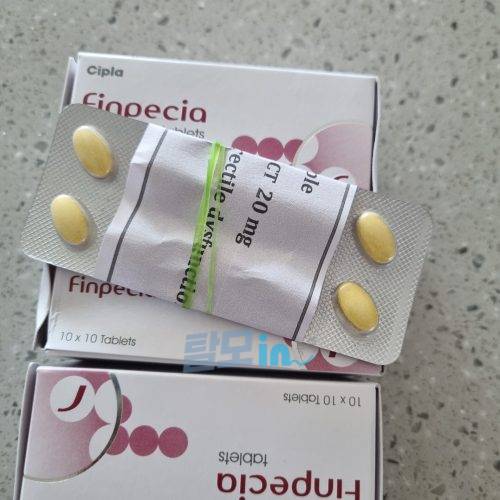 핀페시아 900정 photo review