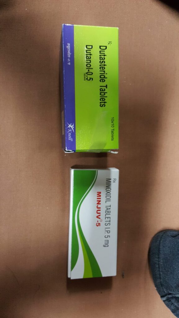 탈모in 후기 모음 photo review