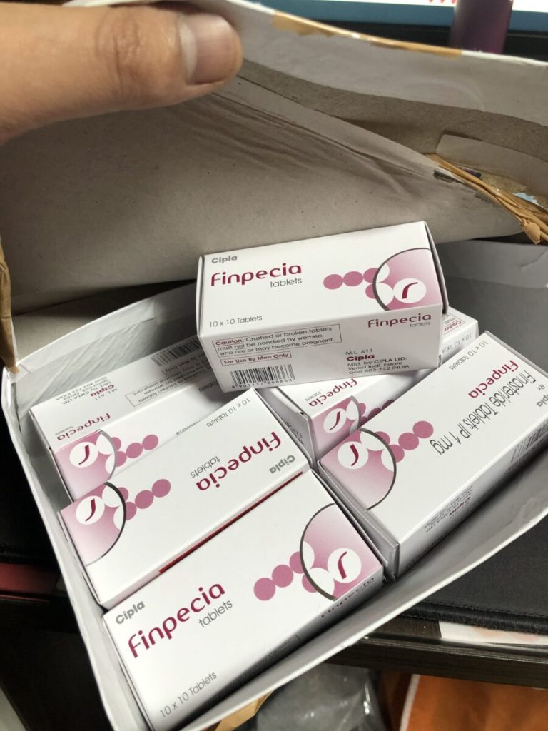 탈모인 탈무 Talmoo 후기 모음 photo review