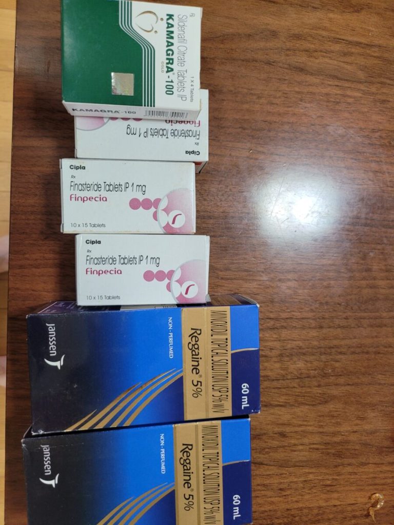 탈모in 후기 모음 photo review