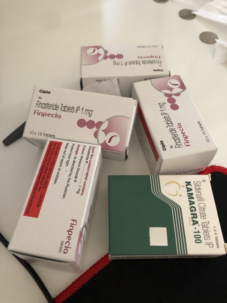 탈모in 후기 모음 photo review