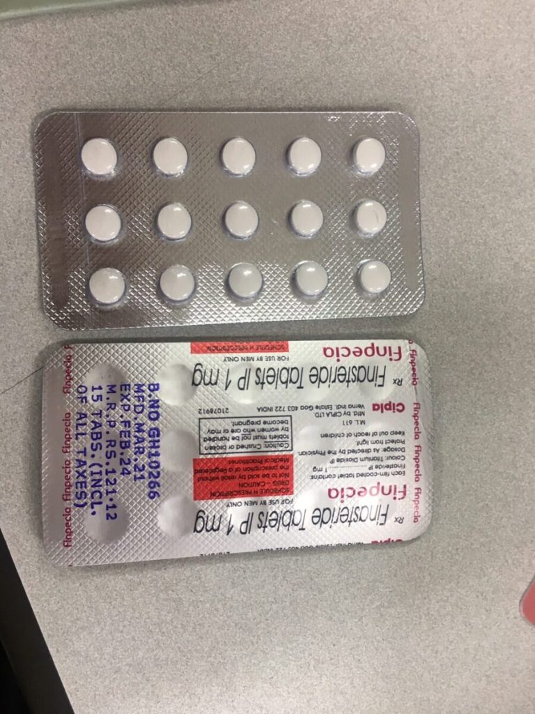 탈모in 후기 모음 photo review