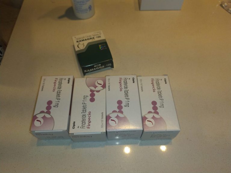 탈무 Talmoo 후기 모음 photo review