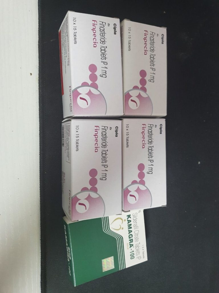 탈모인 탈무 Talmoo 후기 모음 photo review