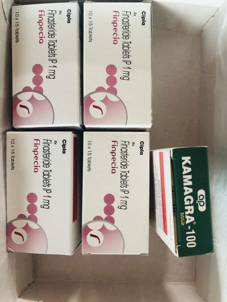 탈모인 탈무 Talmoo 후기 모음 photo review