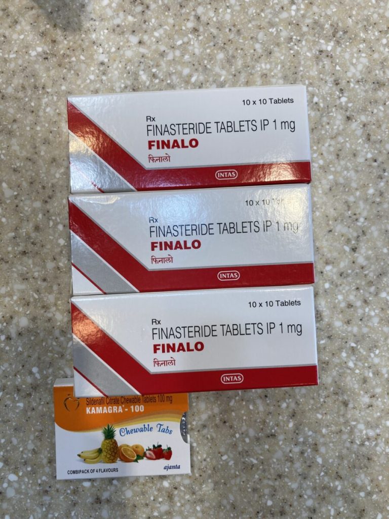 탈모인 탈무 Talmoo 후기 모음 photo review