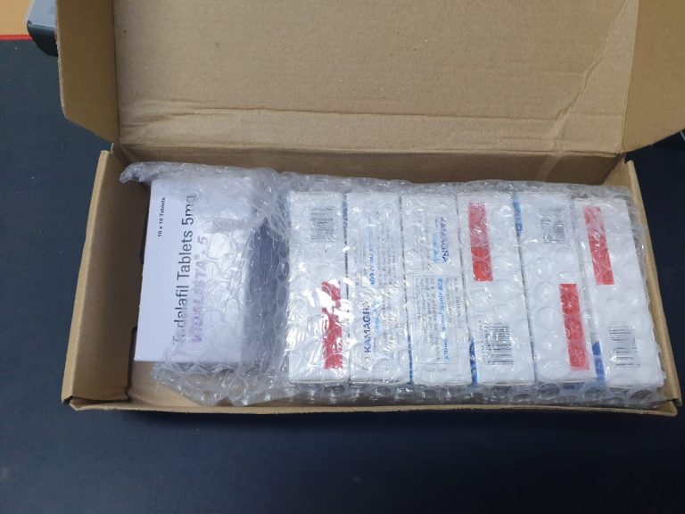 탈무 Talmoo 후기 모음 photo review