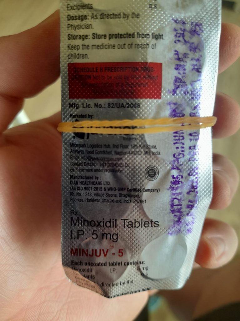 탈모in 후기 모음 photo review