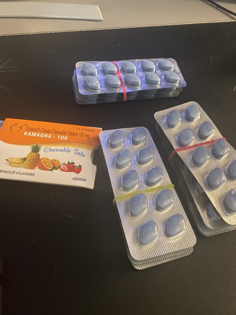 탈무 Talmoo 후기 모음 photo review