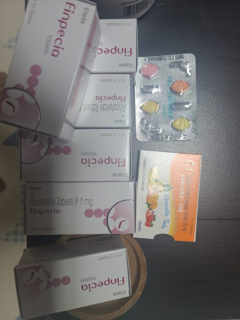탈모in 후기 모음 photo review