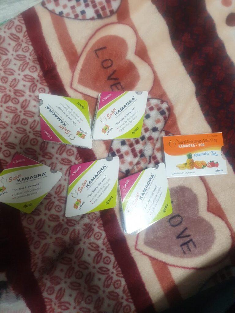 탈모in 후기 모음 photo review