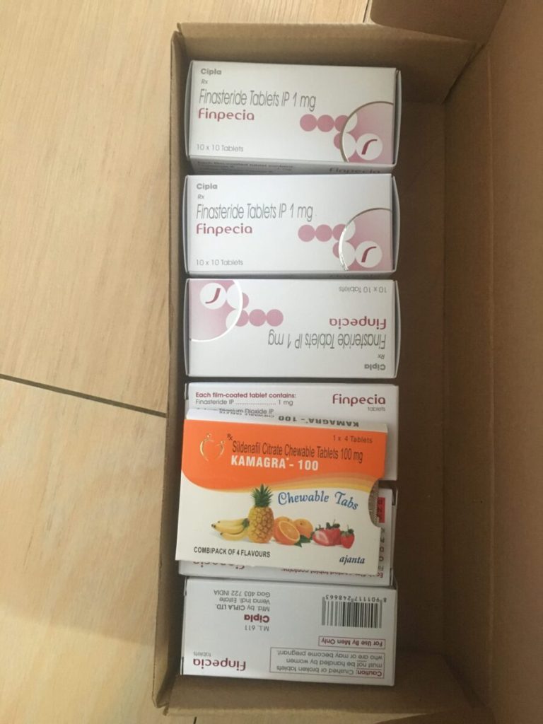 탈모in 후기 모음 photo review