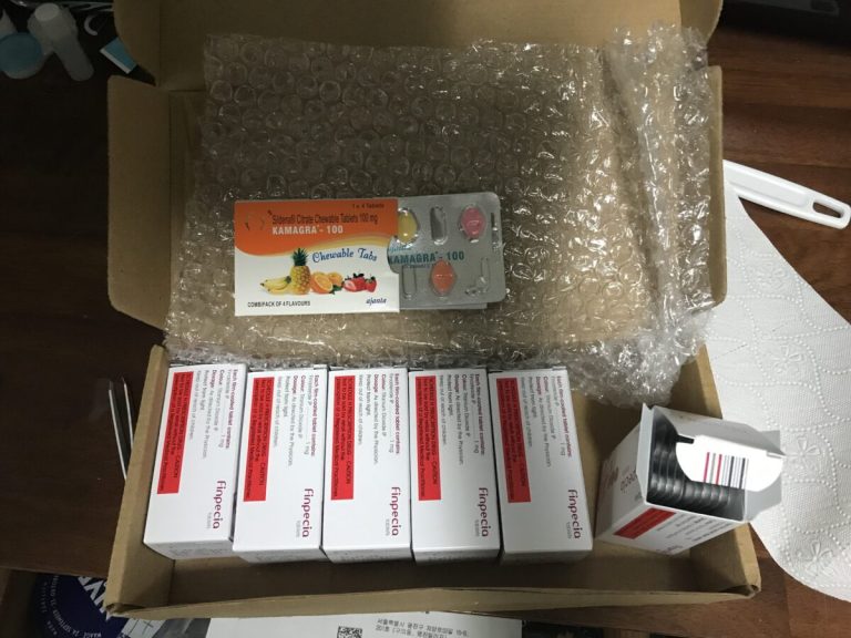 탈모in 후기 모음 photo review