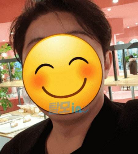 미녹시헤드D 600정 photo review